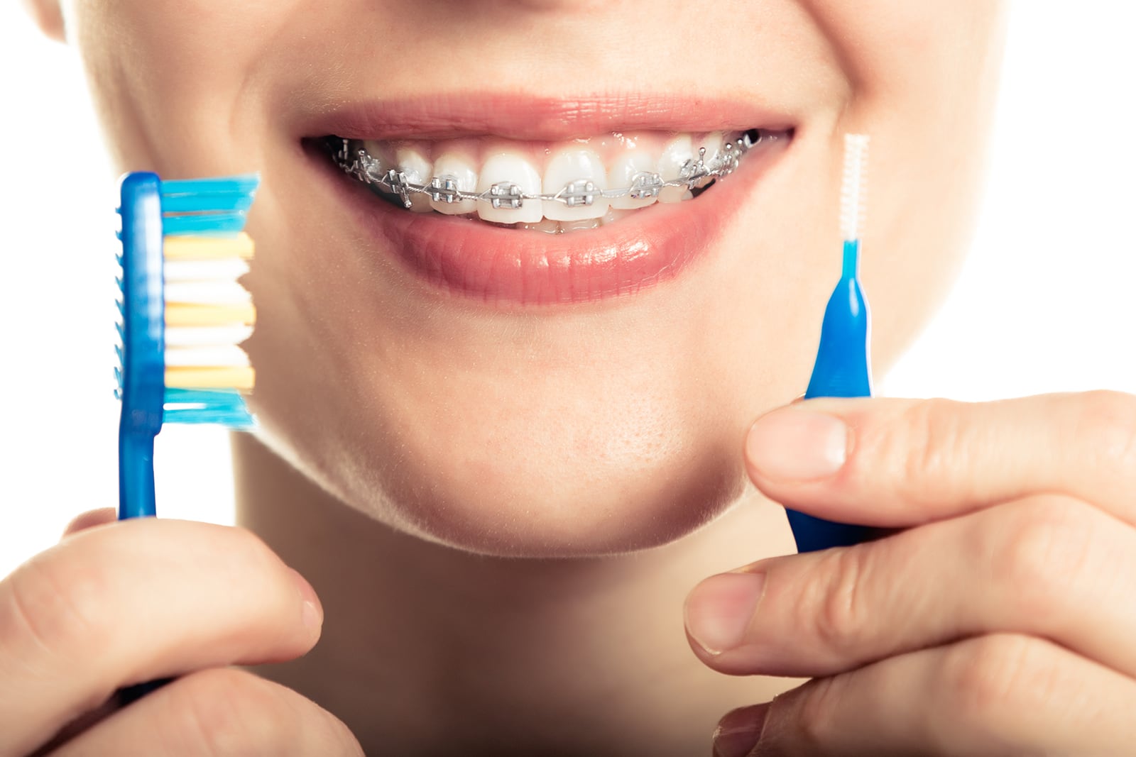 10 Ask Your Dentist What Are Some Must Haves for Cleaning Braces and Aligners v1
