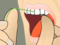 Hands demonstrating proper dental floss placement between teeth during flossing technique.
