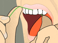 Illustration of step 4 flossing technique showing proper floss placement between teeth and gum line.